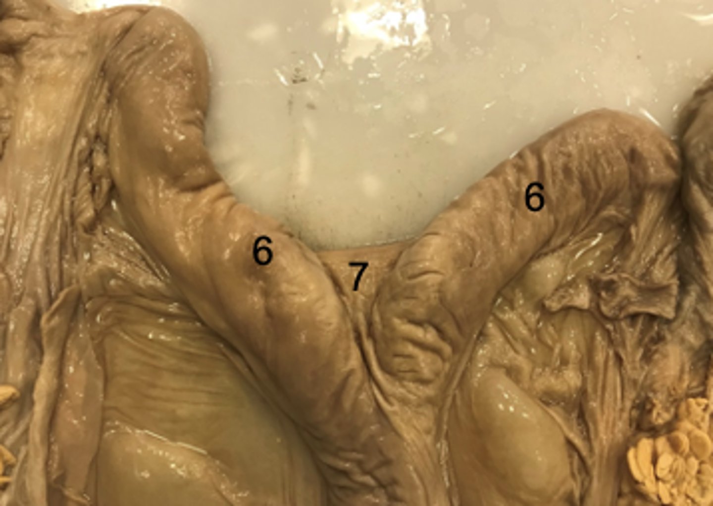 <p>What is #7 on the image?</p>