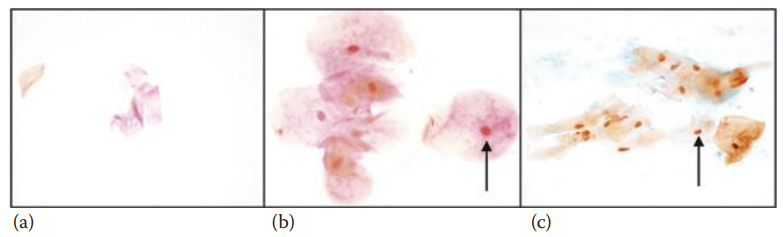 Staining of epithelial cells with Dane’s method. The results obtained using methanol fixation followed by Dane’s staining on skin (a), buccal (b), and vaginal epithelial (c) cells are shown.