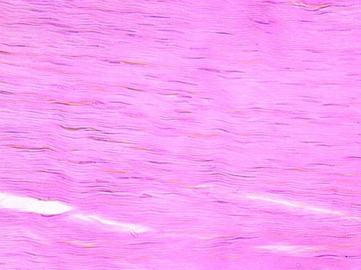 <p>Dense Regular Connective Tissue - Dense Connective Tissue</p>