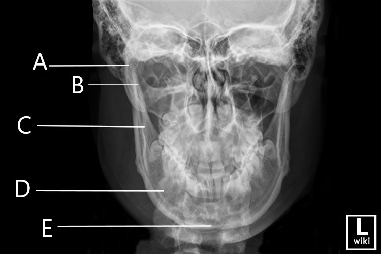<p><strong>Match the letters with the following image:</strong></p>