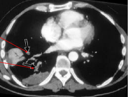 <p>Name the pathology</p>