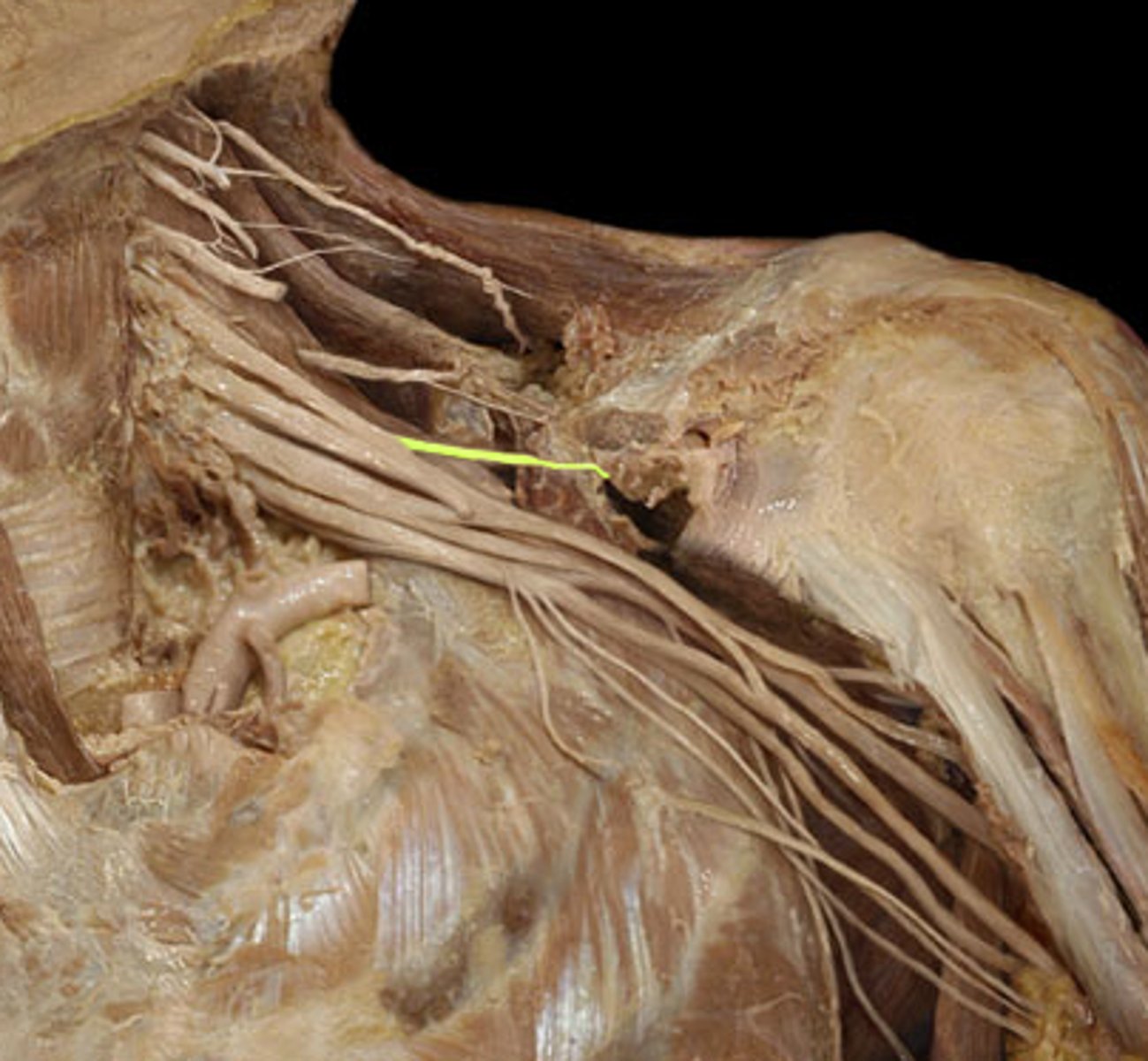 <p>supraspinatus &amp; infraspinatus innervating nerve...</p>