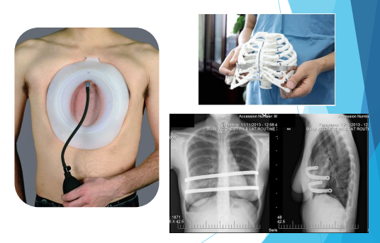 <p>Vacuum bell and surgery </p>