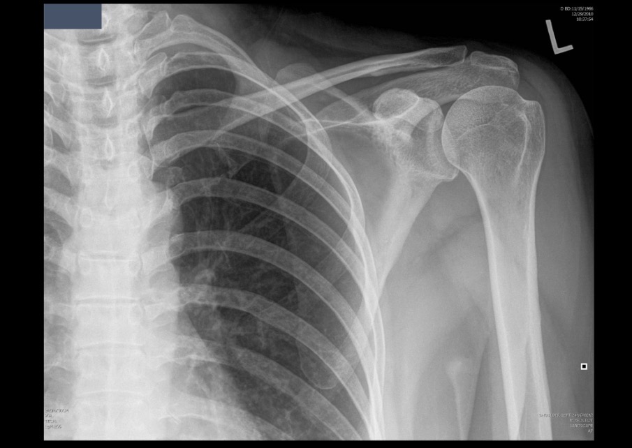 <p>What projection position is this image?</p>