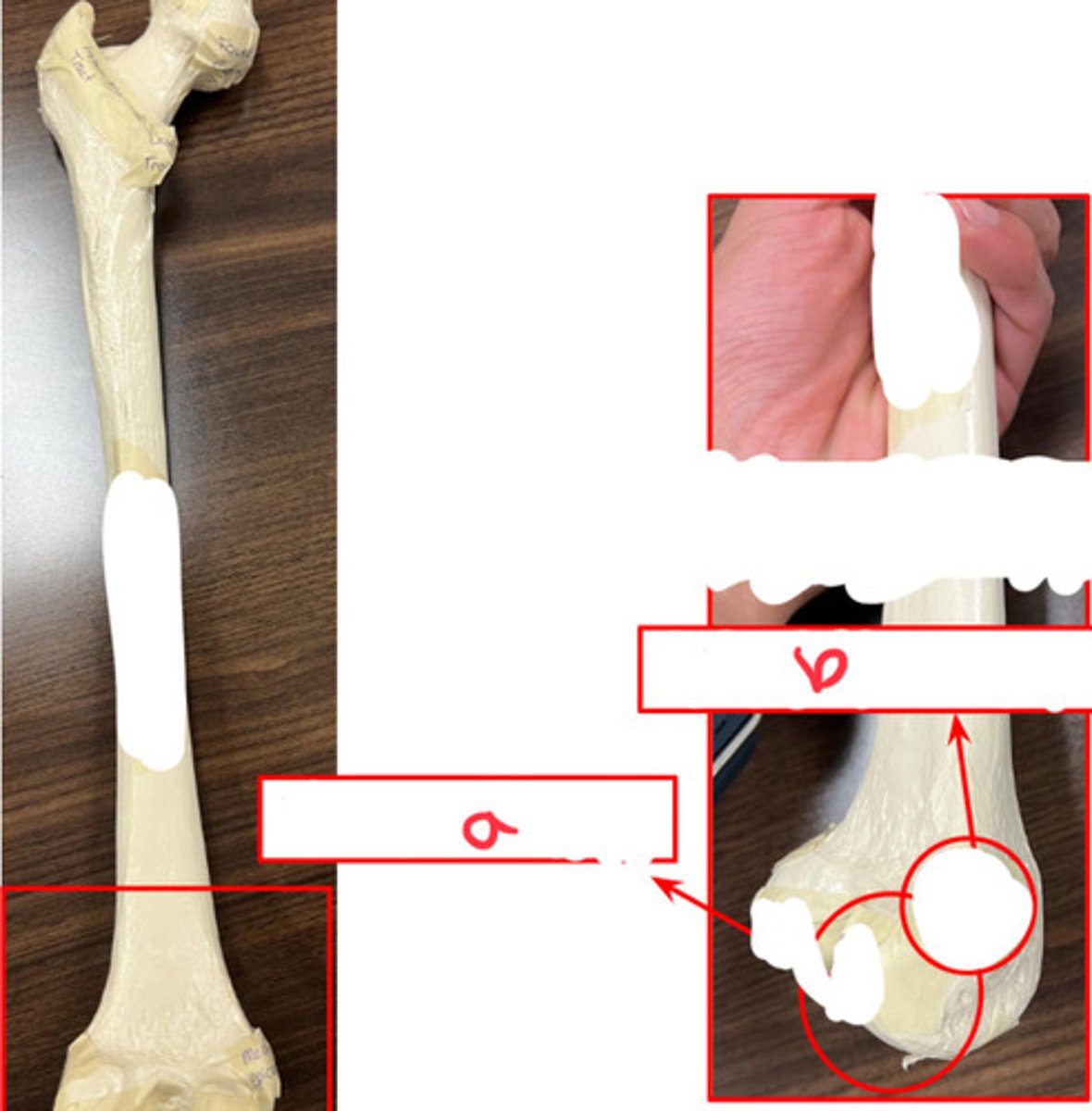 <p>what structure is labeled by a?</p>