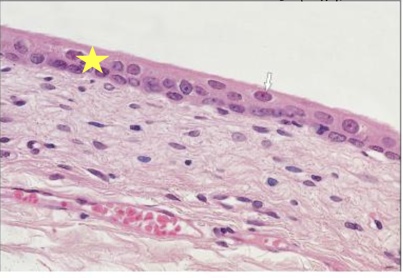 <p>does this histological slide show a relaxed or distended bladder?</p>