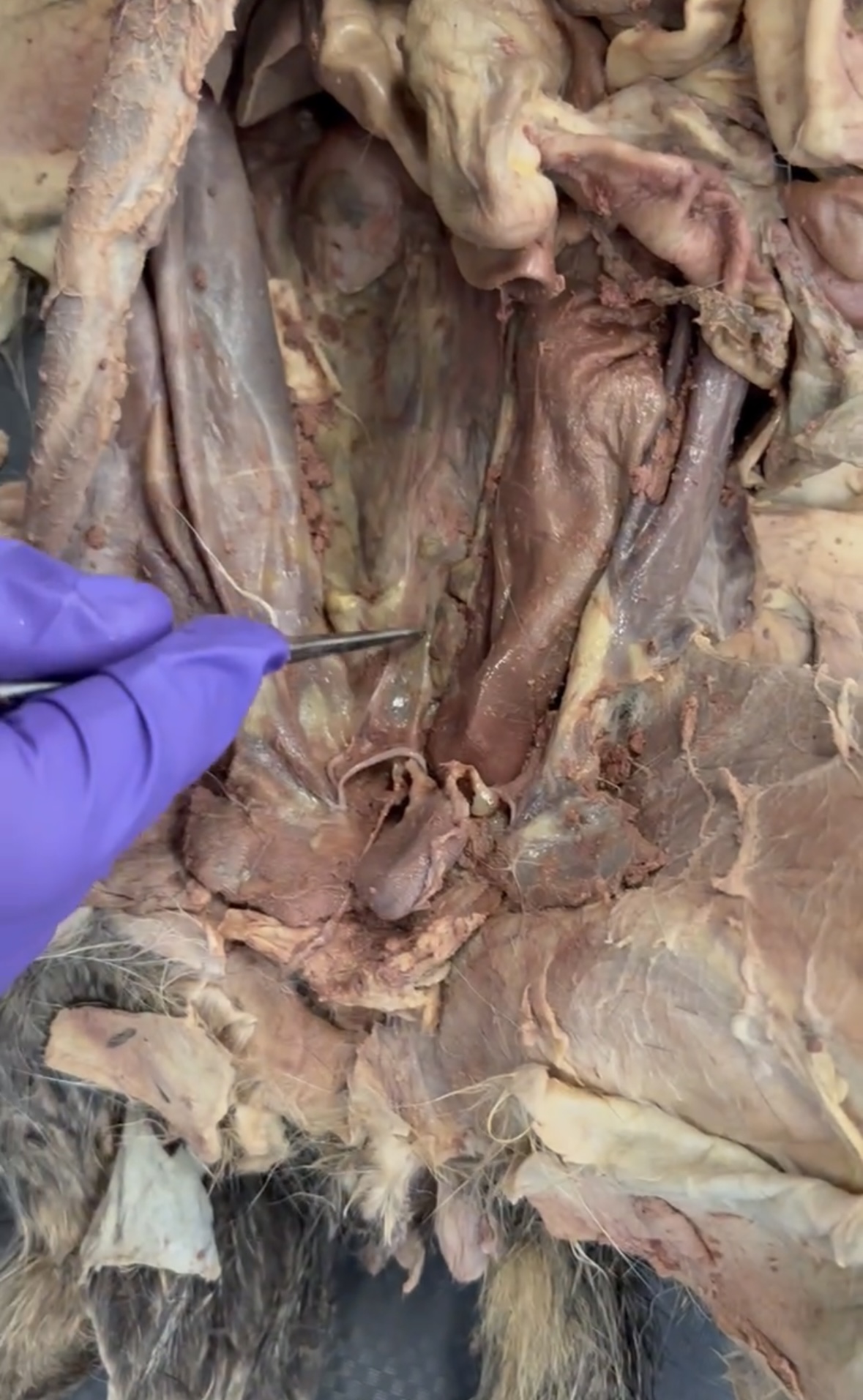 <p>Pointer points to (connects to vas deferens)</p>