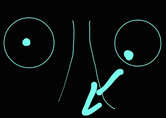 <p>cranial nerve III</p>