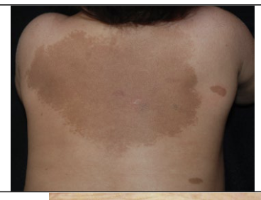 <span style="color: rgb(12, 7, 7);"><span>What kind of skin condition is this?</span></span>