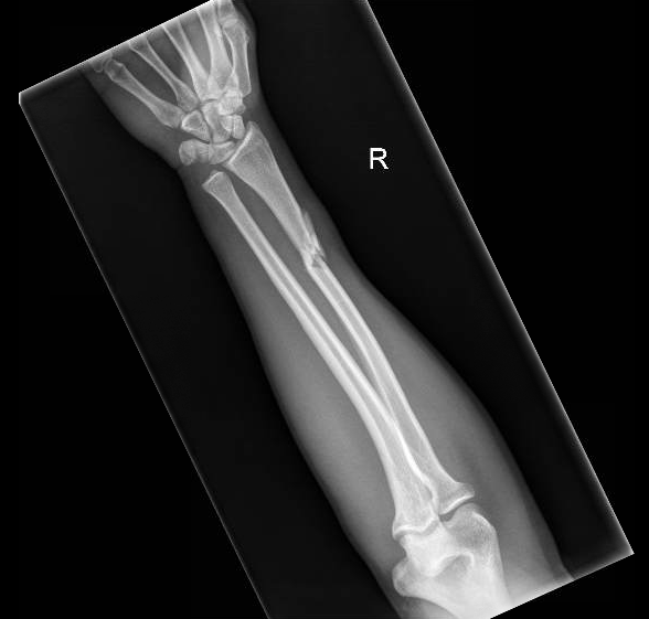 <p>Describe the abnormality demonstrated. </p>