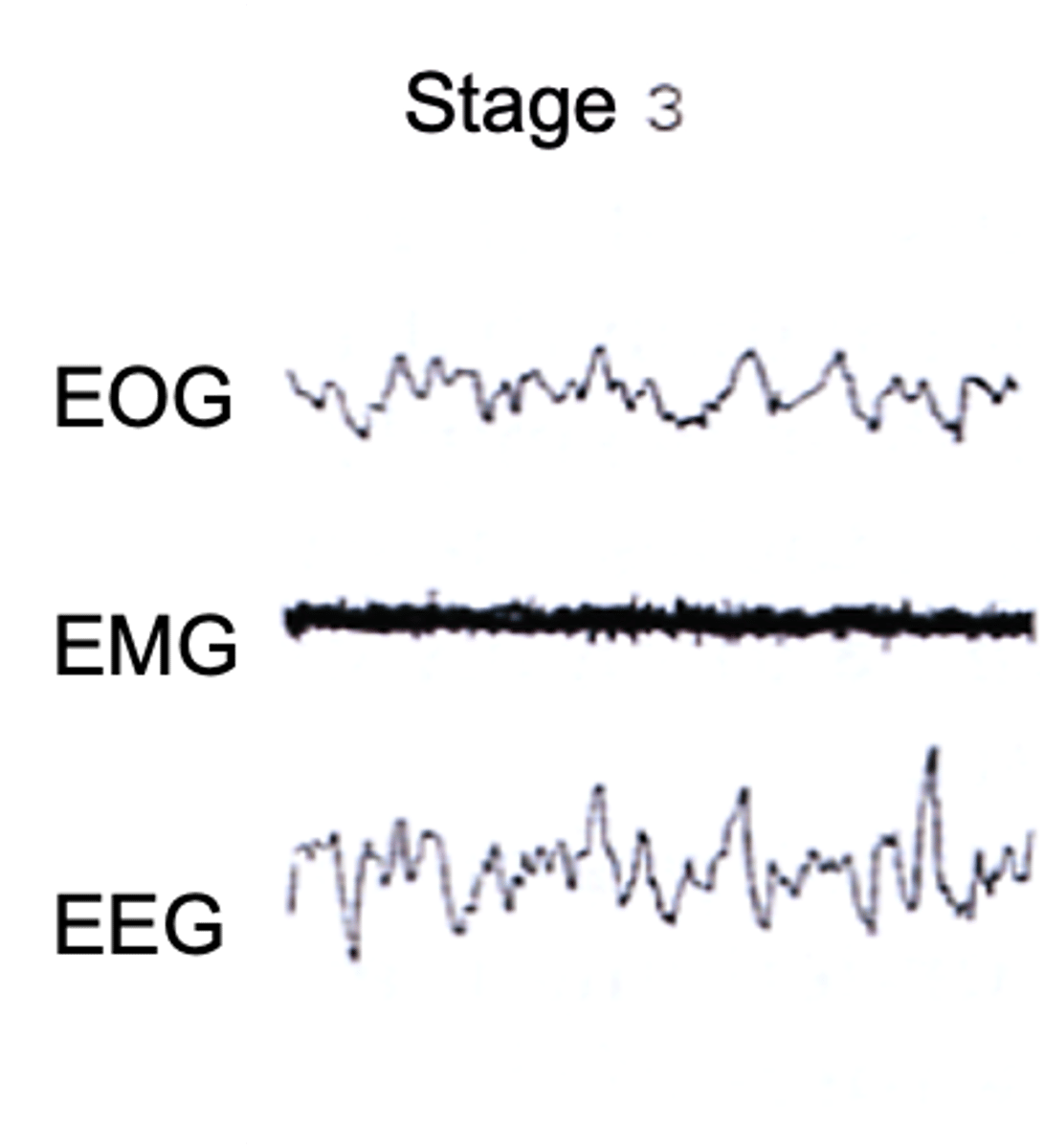 <p>Describe the EEG of Stage 3 of non-REM sleep</p>