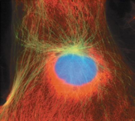 <p>What stage of mitosis is shown here?</p>