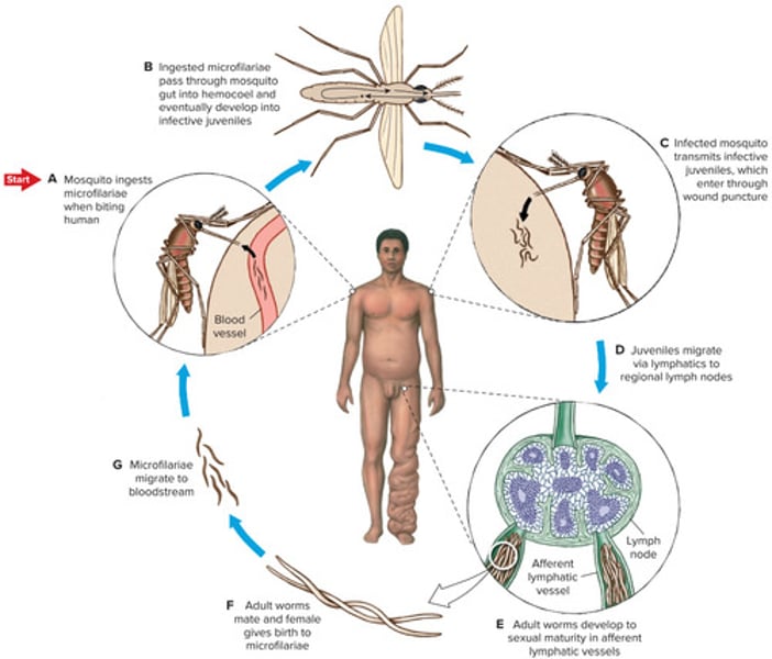 <p><em>Wuchereria bancrofti</em> block vessels of lymphatic system -&gt; causes scarring and extreme swelling (elephantiasis), vectored by mosquitos</p>