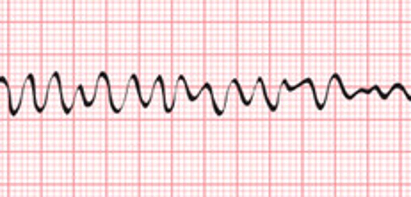 <p>EMERGENCY</p><p>CPR and dfib</p><p>just a bunch of up downs</p>