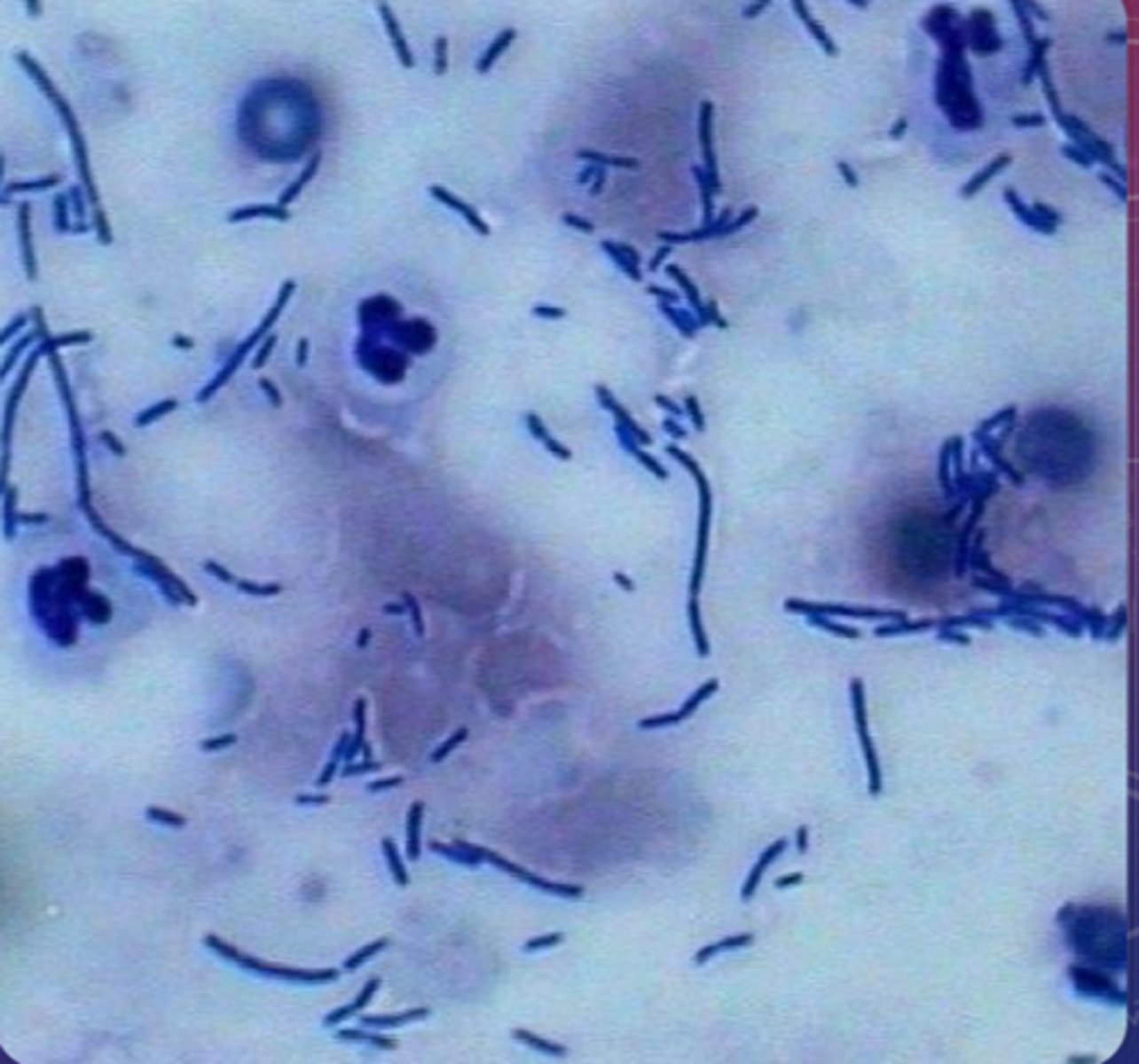 <p>Baccilus/Rods</p>