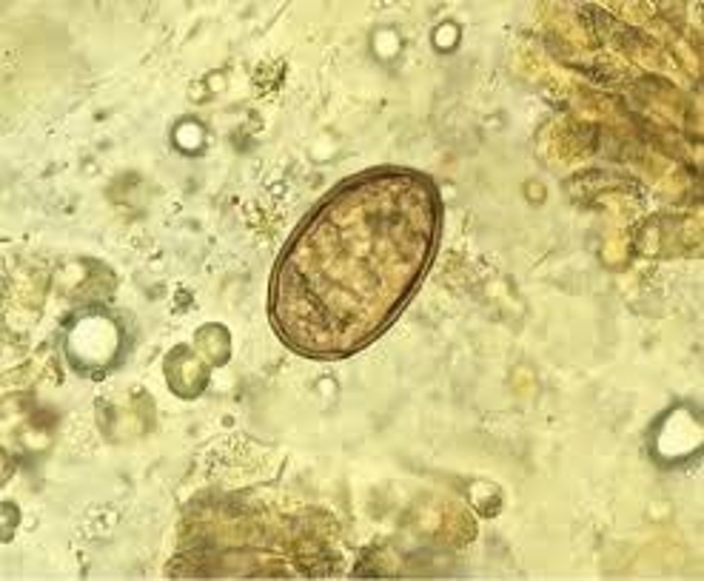<p>Host: Felines</p><p>1st I. Host = land snail, 2nd I. Host = lizard</p>