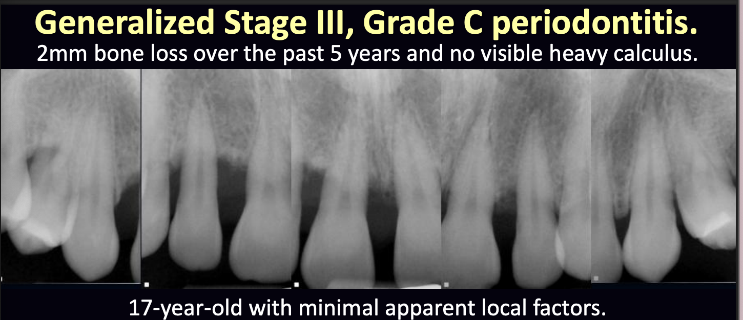 <p>what therapy might be indicated in this case?</p>