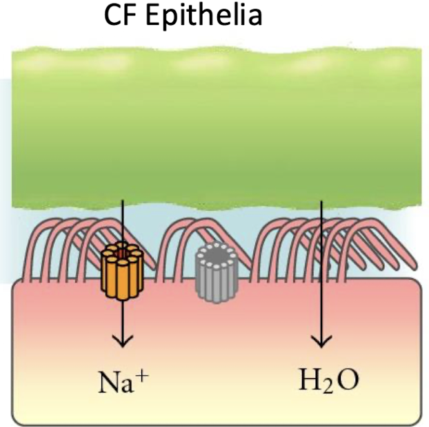 <p><u><mark data-color="blue" style="background-color: blue; color: inherit;">Respiratory Symptoms</mark></u></p><p>• A persistent cough that produces thick mucus (sputum)</p><p>•Wheezing</p><p>•Breathlessness</p><p>•Exercise intolerance</p><p>•Repeated lung infections</p><p>•Inflamed nasal passages or a stuffy nose</p><p><u><mark data-color="blue" style="background-color: blue; color: inherit;">Digestive Symptoms (</mark></u>GI)</p><p>•Steatorrhea (foul smelling greasy stool)</p><p>•Failure to thrive</p><p>•Intestinal blockage (newborns)</p><p>•Severe constipation</p>