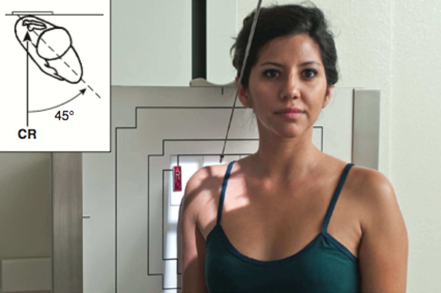 <p>patient erect or supine at 45 degrees toward affected side</p><p>CR at 45 degree caudad angle and centered at scapulohumeral joint</p>