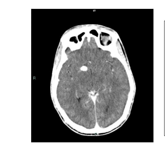 <p>What is the pathology?</p>