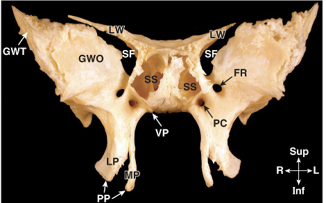 <p>What area of the sphenoid does LW stand for?</p>