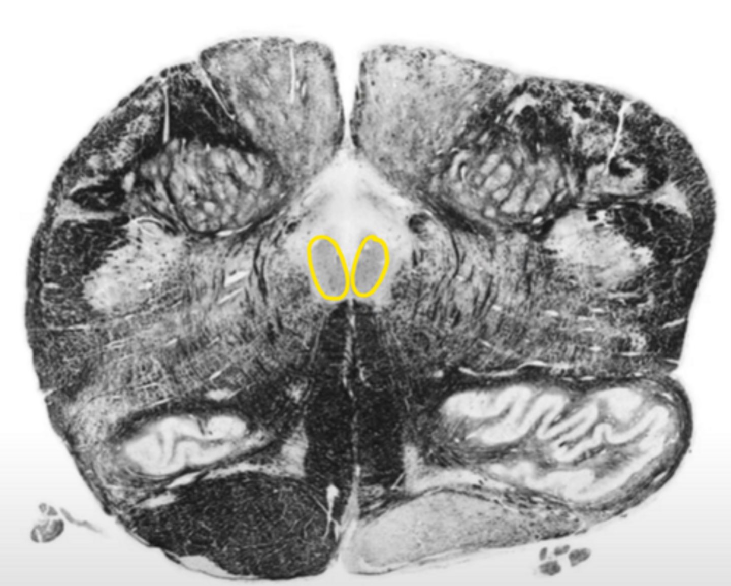 <p>ID the nucleus</p>