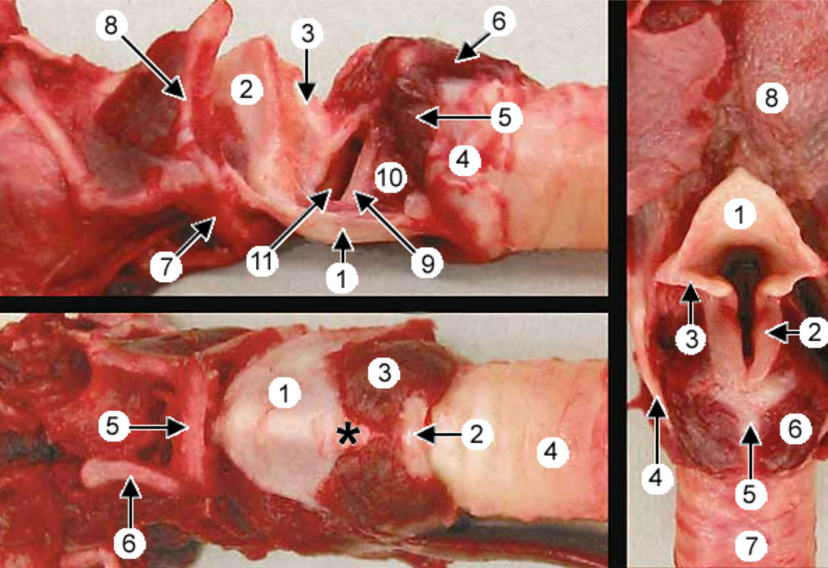 <p>label the larynx: 3 (bottom left pic), 6 (top left and right pic)</p>