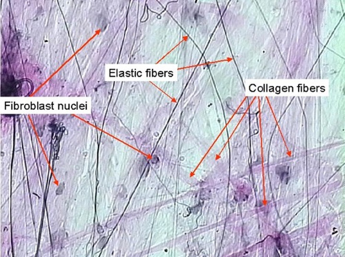 <p>Matrix: collagen, elastin fibers, and reticular fibers</p><p>Cells: fibroblasts, fibrocytes, mast cells (histamine and heparin) and macrophages</p><p>Location: around nerves and BV, dermis , hypodermis , as sheets of tissue between muscles, forms adventitia, synovial membrane</p><p>Function: attaches epithelial tissues, diffusion, binds organs, immune function</p><p>Characterized by mast cells: induction of inflammatory response - contain granules that have local chemical compounds called histamine and heparin and stimulates redness of tissue</p><p>Heparin - prevents coagulation of blood</p><p>Histamine:</p>