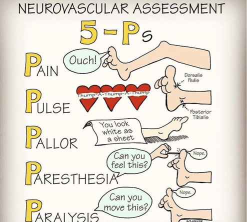 <ul><li><p>“Five Ps” will help you to focus on specific musculoskeletal symptoms or injuries.</p><ul><li><p>Pain</p></li><li><p>Paralysis</p></li><li><p>Paresthesia</p></li><li><p>Pallor</p></li><li><p>Pulselessness</p></li></ul></li></ul><p></p>