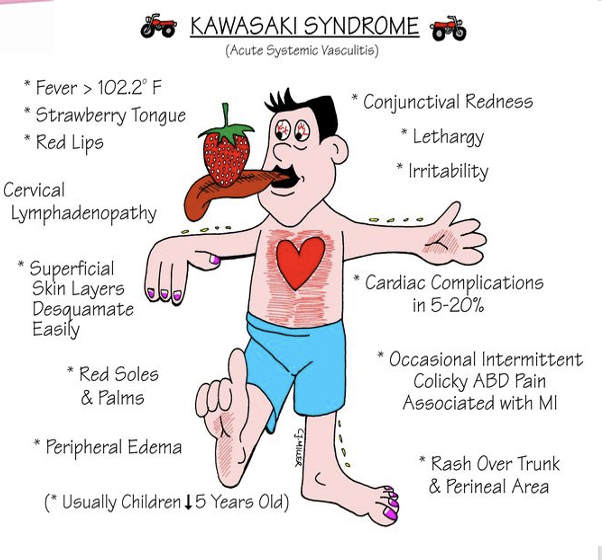 <ul><li><p><span><span>Strawberry tongue</span></span></p></li><li><p><span><span>red soles and palms</span></span></p></li><li><p><span><span>peripheral edema</span></span></p></li><li><p><span><span>epithelial layer isn’t then protective anymore</span></span></p></li></ul><p></p>