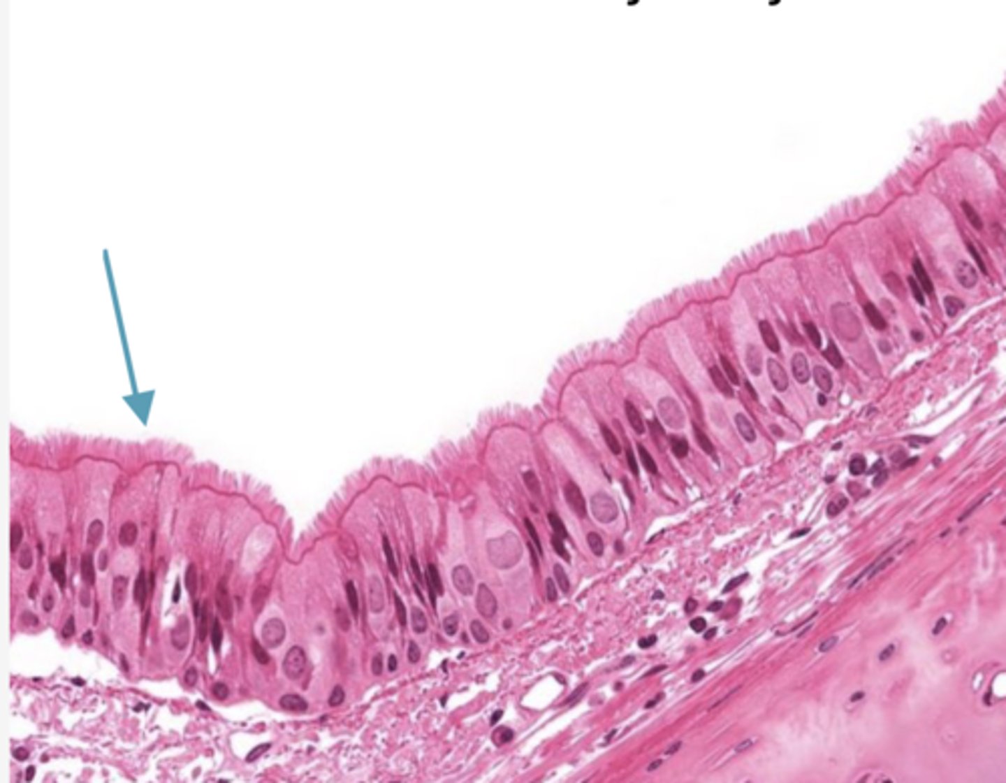 <p>Identify the structure being pointed to (in the tagged structure list)</p>