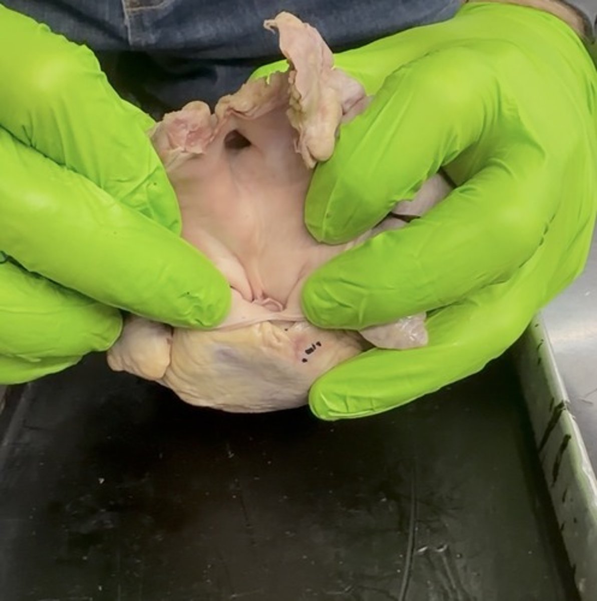 <p>inside pulmonary trunk</p>