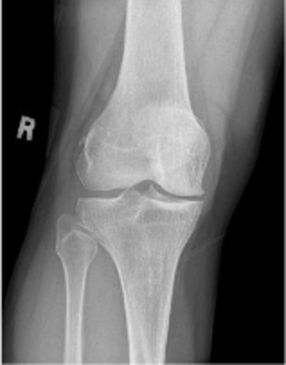 <p>What is the name of the radiographic view?</p>