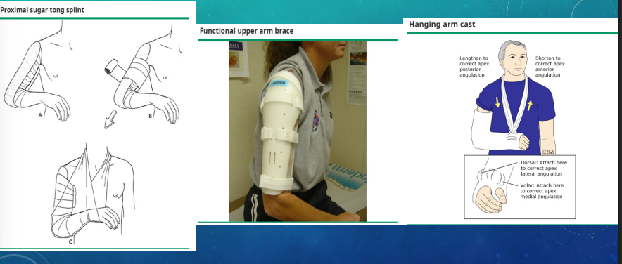 <p><strong>Midshaft Humerus Fractures: Treatment</strong></p><p>-Refer to ______</p><p>-Non-operative options: </p><ul><li><p>Initial → sugar tong _____ or sling and swathe</p></li><li><p>Transverse → _________ brace </p></li><li><p>Nonsurgical displaced oblique or spiral → hanging ____ or functional brace </p></li></ul><p>-Operative: </p><ul><li><p>____ for open fracture, vascular, or brachial plexus injuries with pain and weakness </p></li></ul><p>-Healing time = __-__ weeks </p>