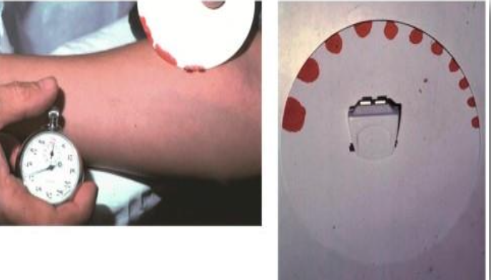 <p>This test is used to measure&nbsp;?</p>