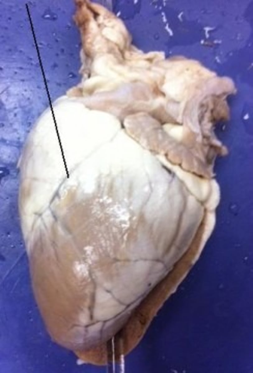 <p>Identify the two blood vessels that run along this groove.</p>