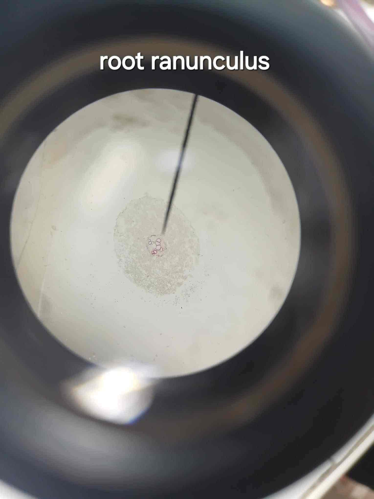 <p>Specialized plastids for starch storage found in the root of Ranunculus sp.</p>