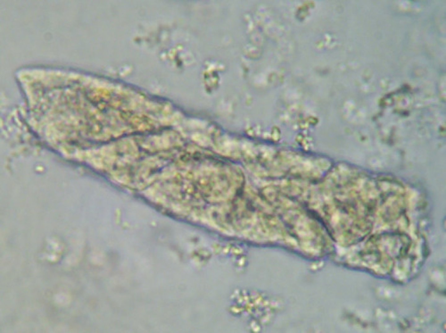<p>Are representative of extreme urine stasis indicating chronic renal failure</p><p>- They have a brittle and highly refractile cast matrix</p><p>- They often appear fragmented with jagged ends and have notches on their sides</p>
