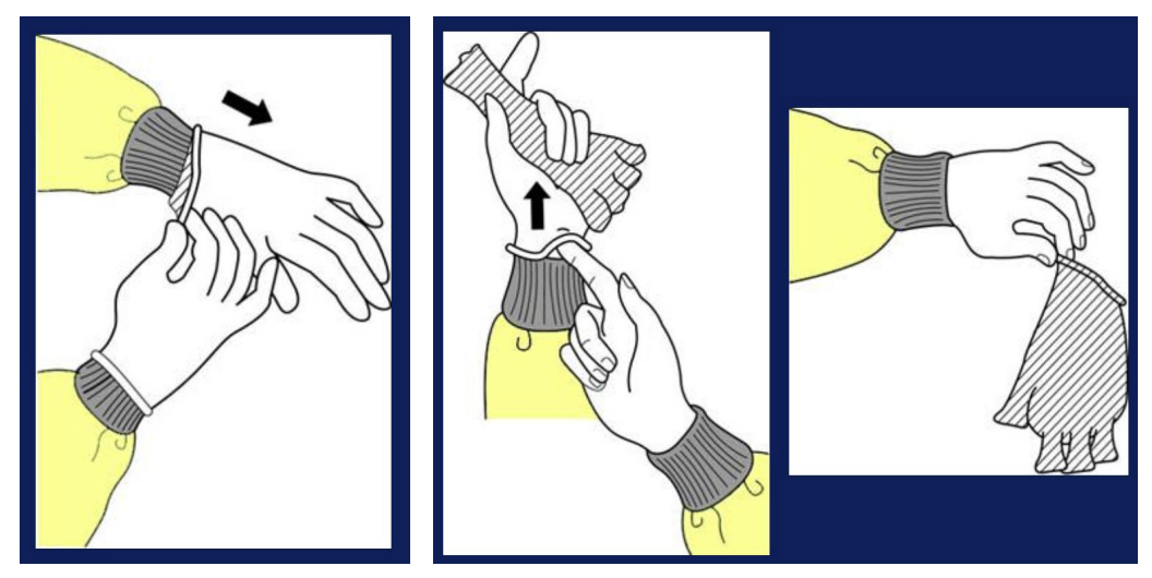 <p>How to remove gloves properly</p>