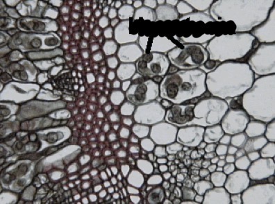 <p>What cells are being pointed at, and what do they do?</p>