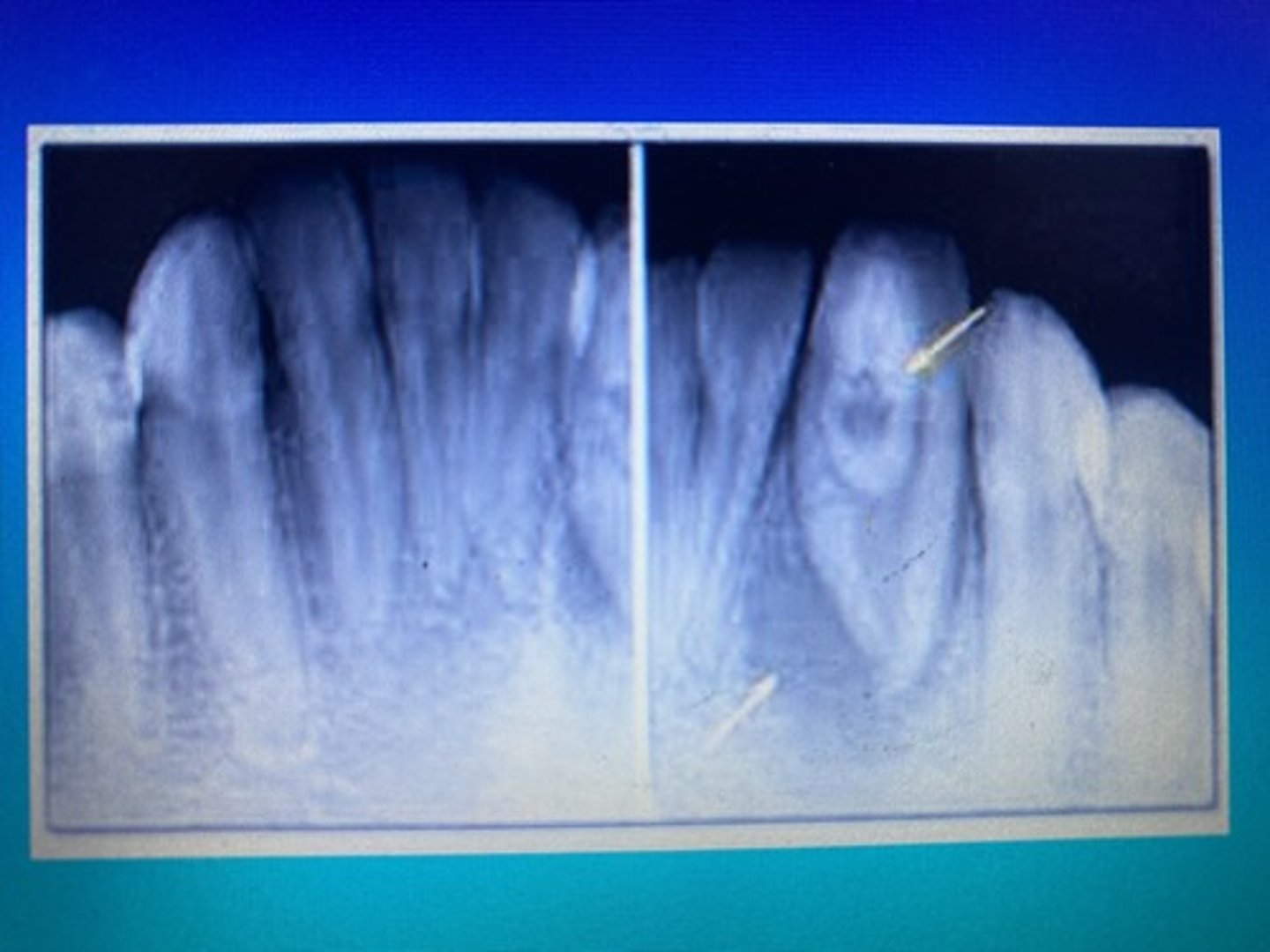 <p>Dens In Dente</p>