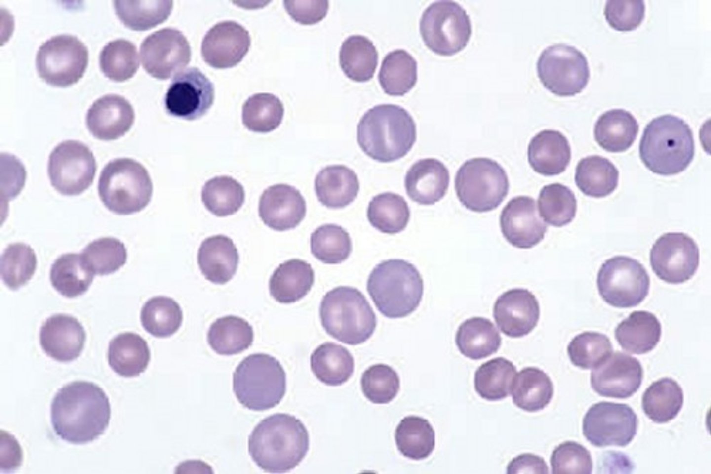 <p>(cell color)</p><p>Increased variation in pigmentation</p>
