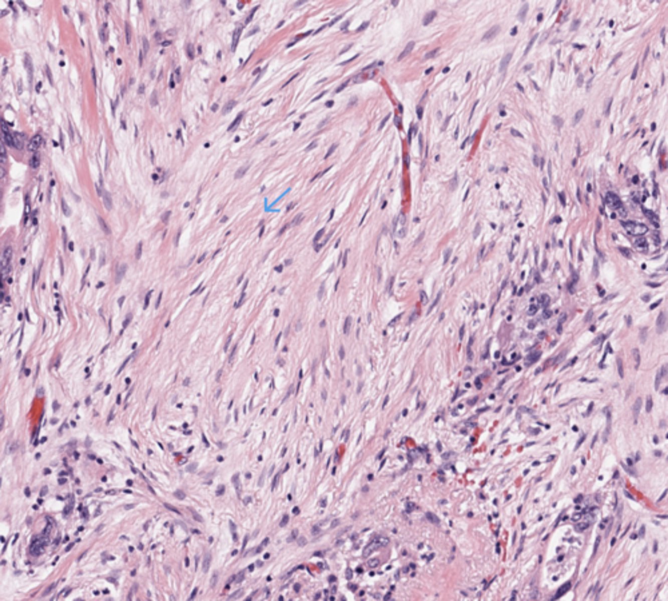 <p>Pancreas</p>