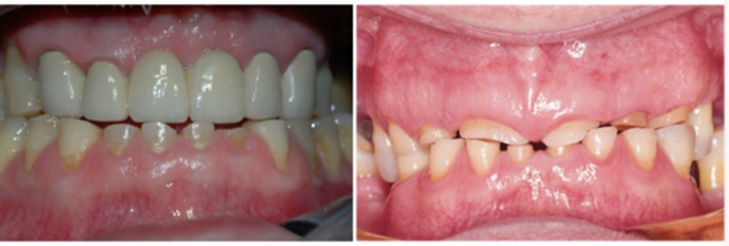 <p>How would you describe the dentition?</p>