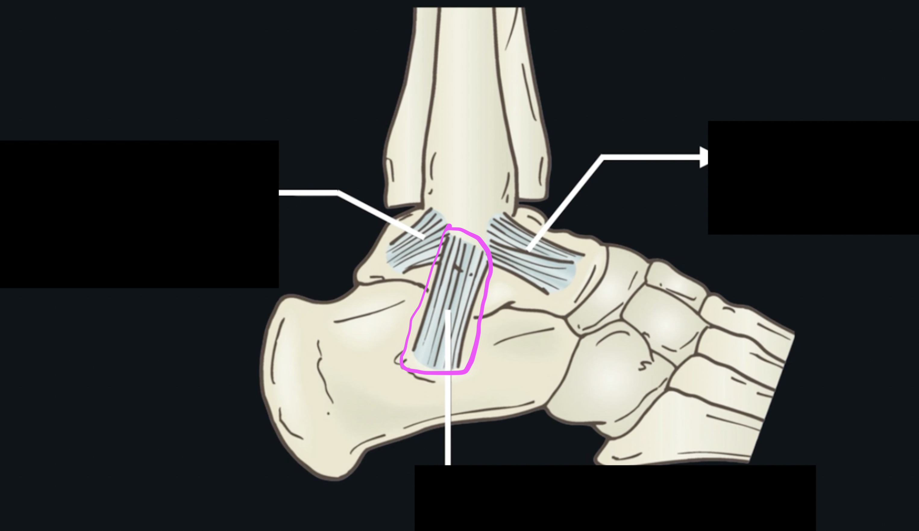 <p>What ligament is this? </p>