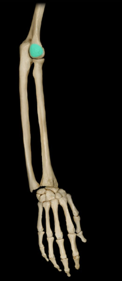 <p>Lateral epicondyle of humerus</p>