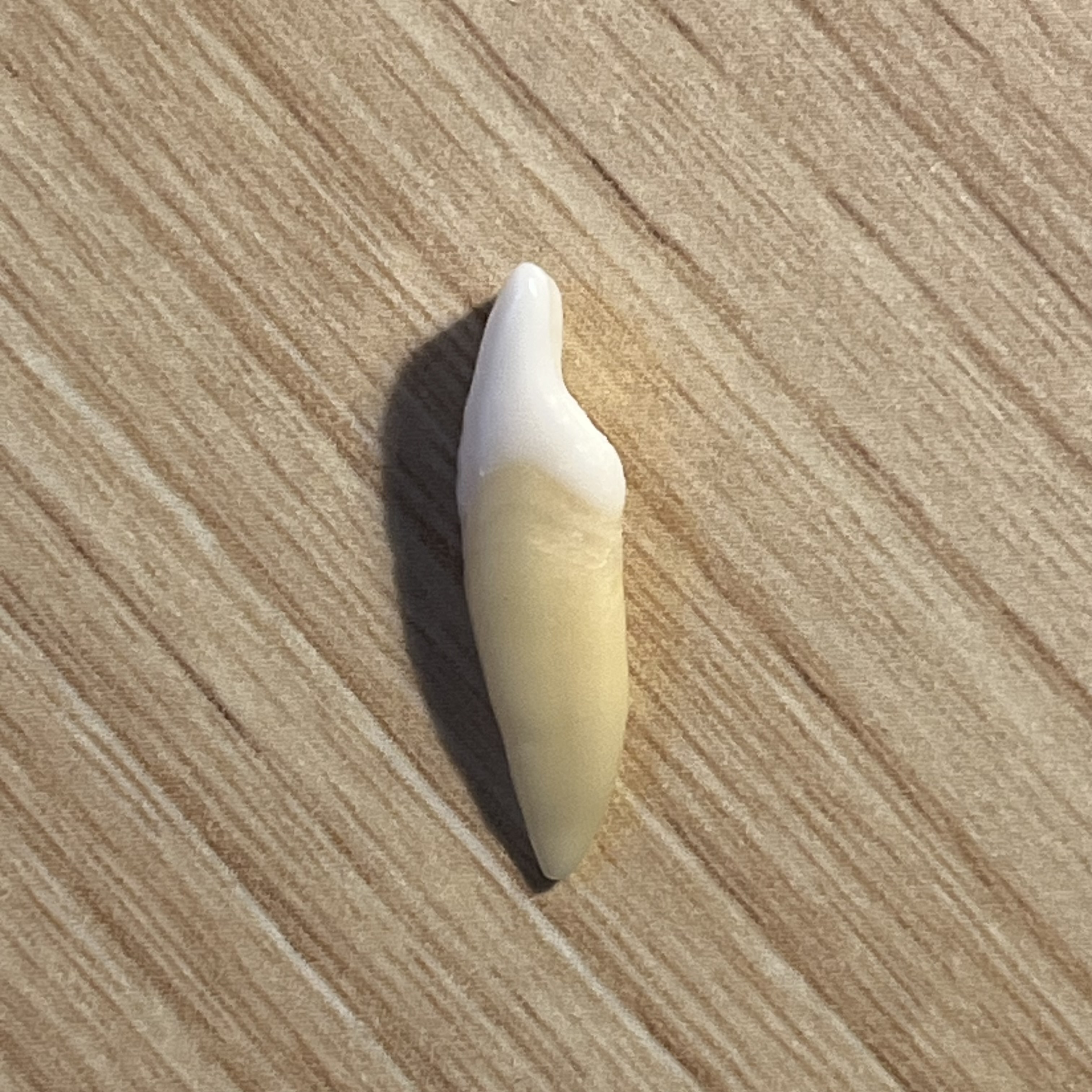 <p>What tooth is this (with view)?</p>