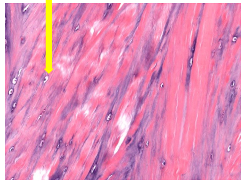 <p>what tissue is this</p>
