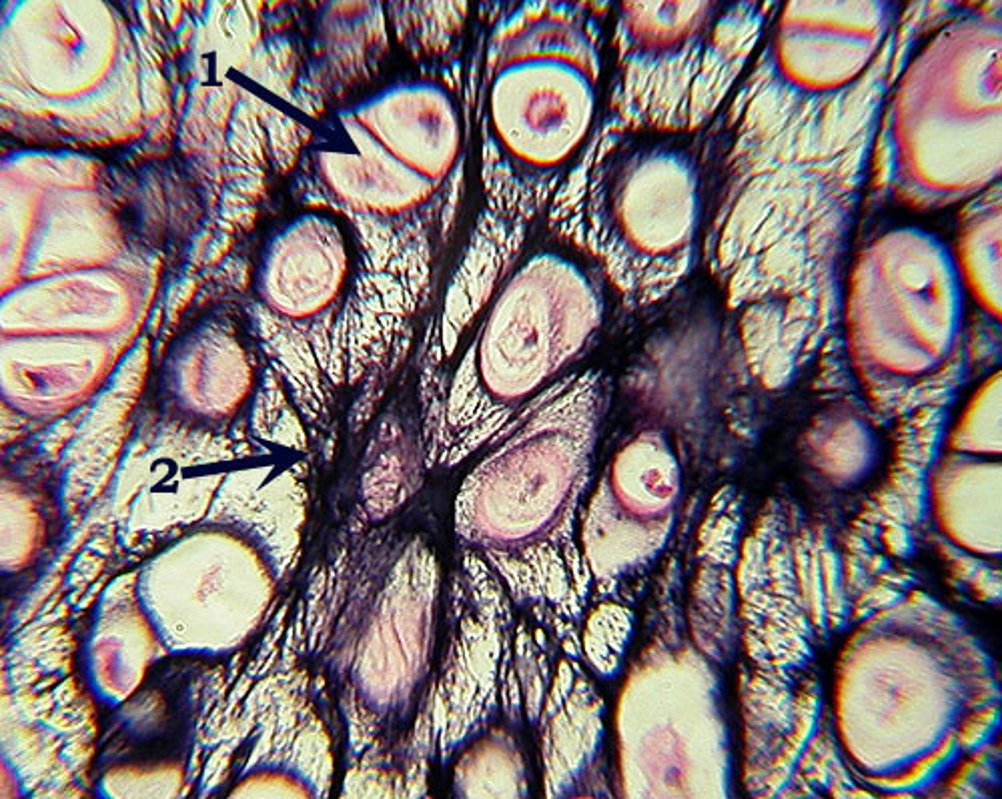 <p>Cartilage that looks like a dense network of dark, wavy elastic fibers with cells (chondrocytes) in small spaces (lacunae), giving it a flexible, springy appearance.</p>
