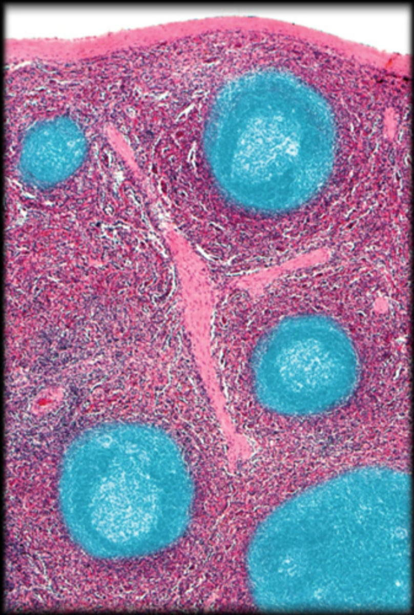 <p>Spleen</p>